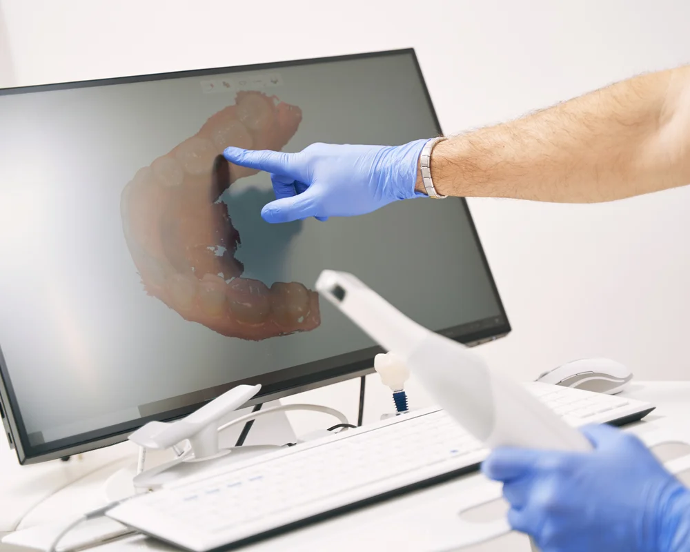 scanner intraorale
