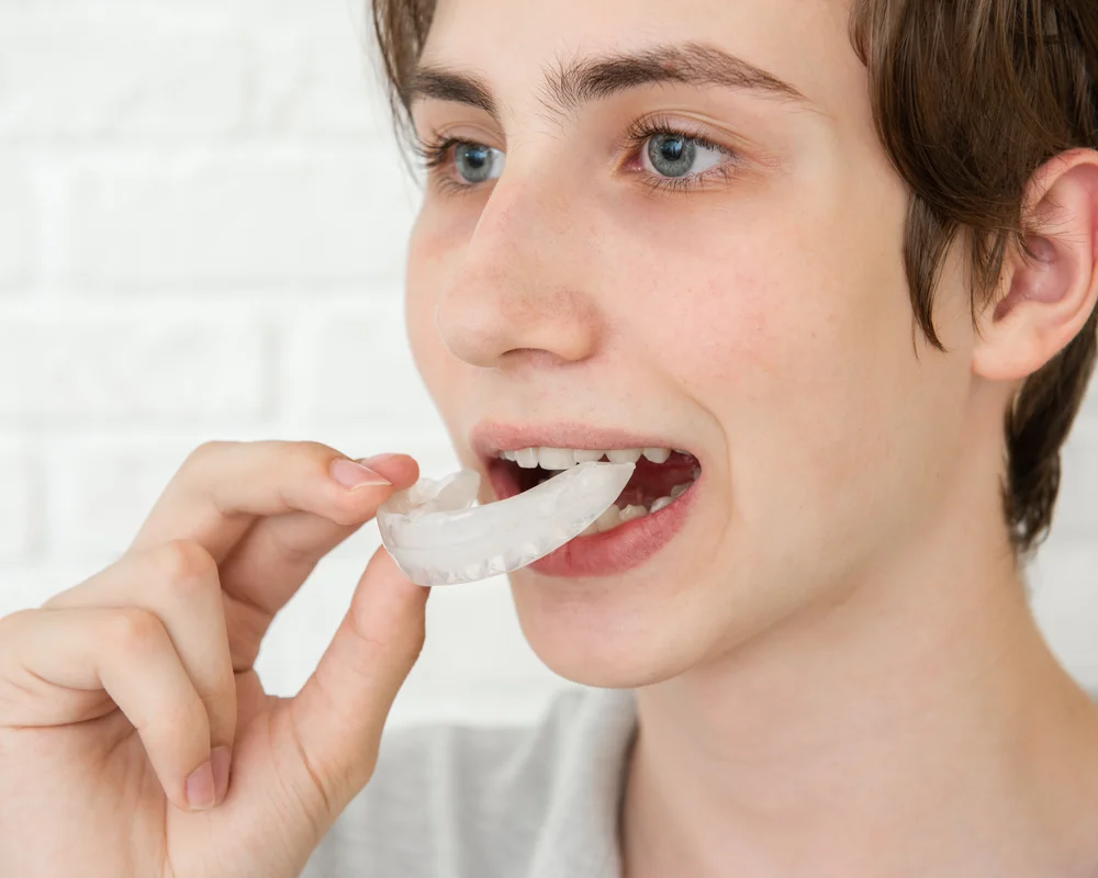 Ragazza con bite